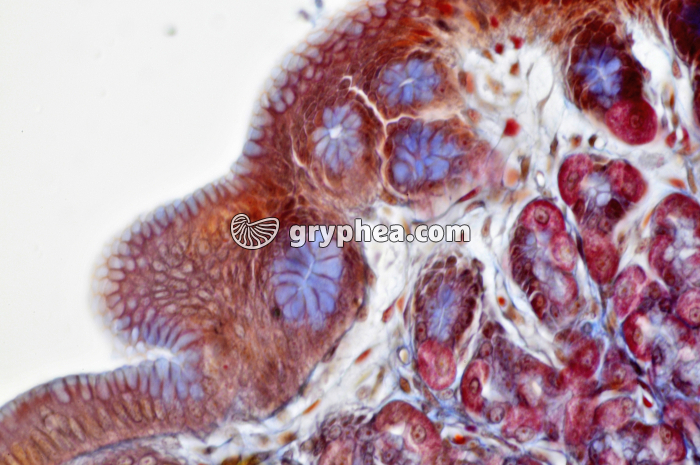 Estomac x160 - gryphea.org